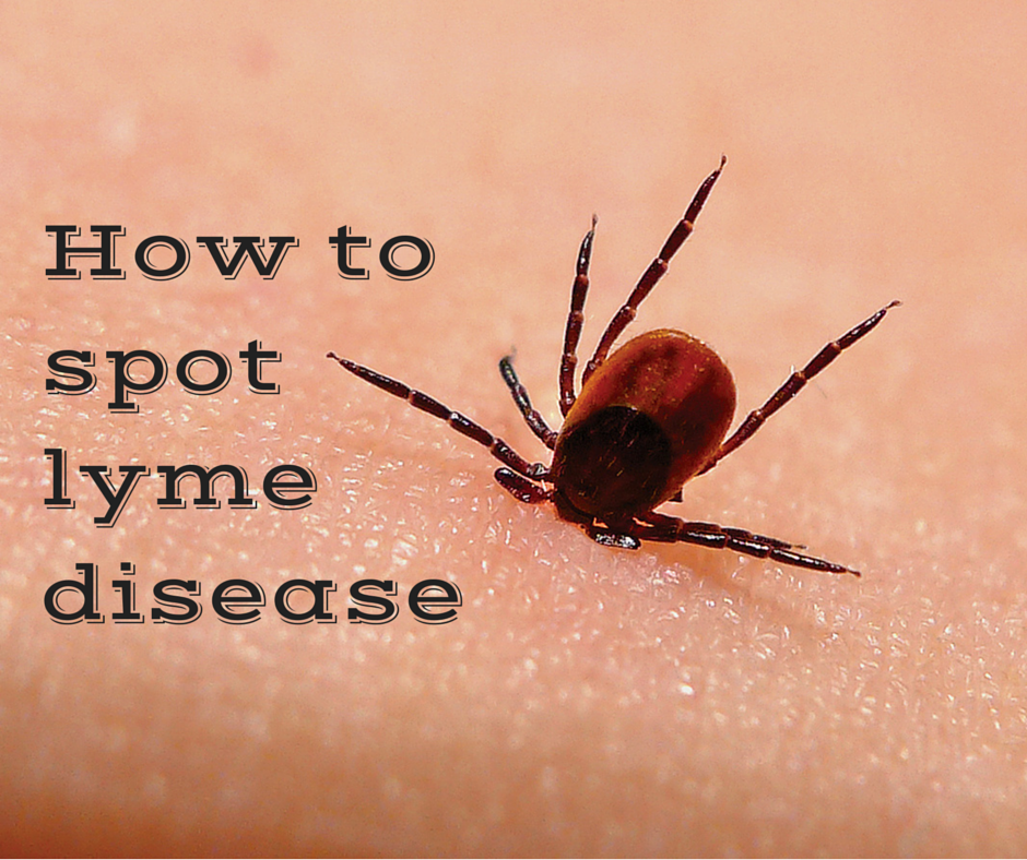 tick on human skin, text reading "How to spot Lyme Disease"