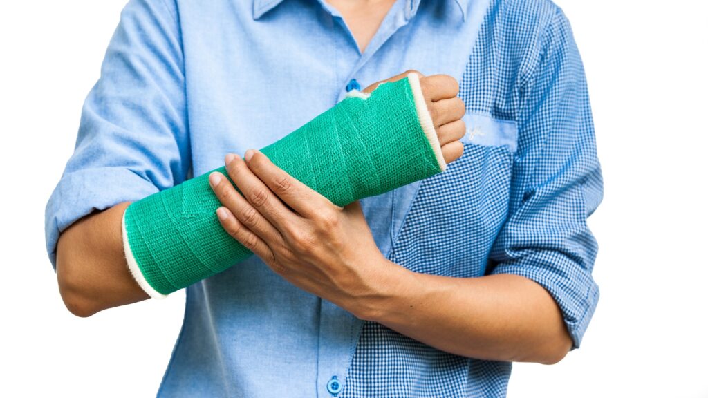 arm in green cast