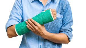 arm in green cast