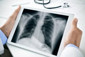 digital x-rays