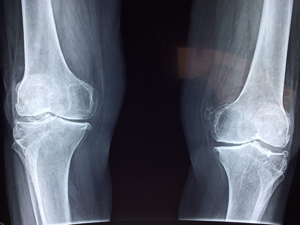uses for x-rays
