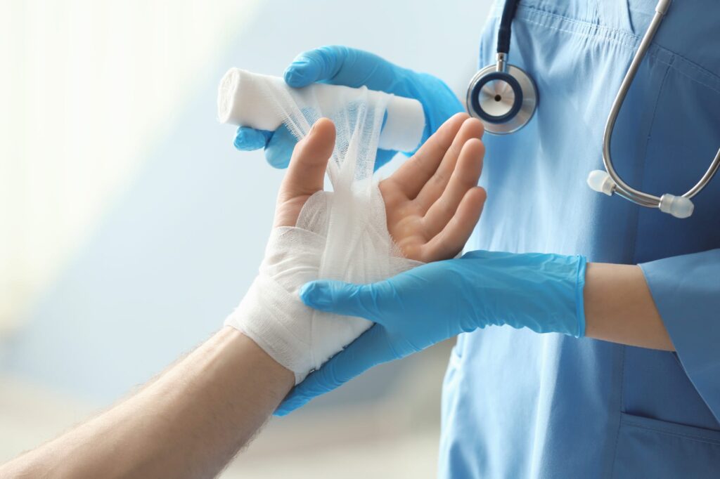 burn first aid