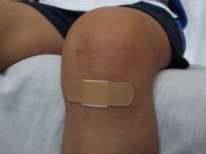 wound care