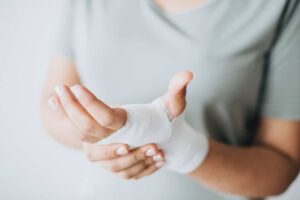 signs of sprains