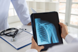 Two doctors review a digital x-ray of a shoulder joint on a tablet computer.