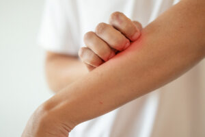 Close up of a man scratching his arm.